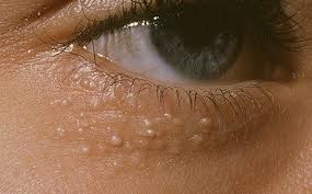 O século queimando-se de olhos avolumou-se